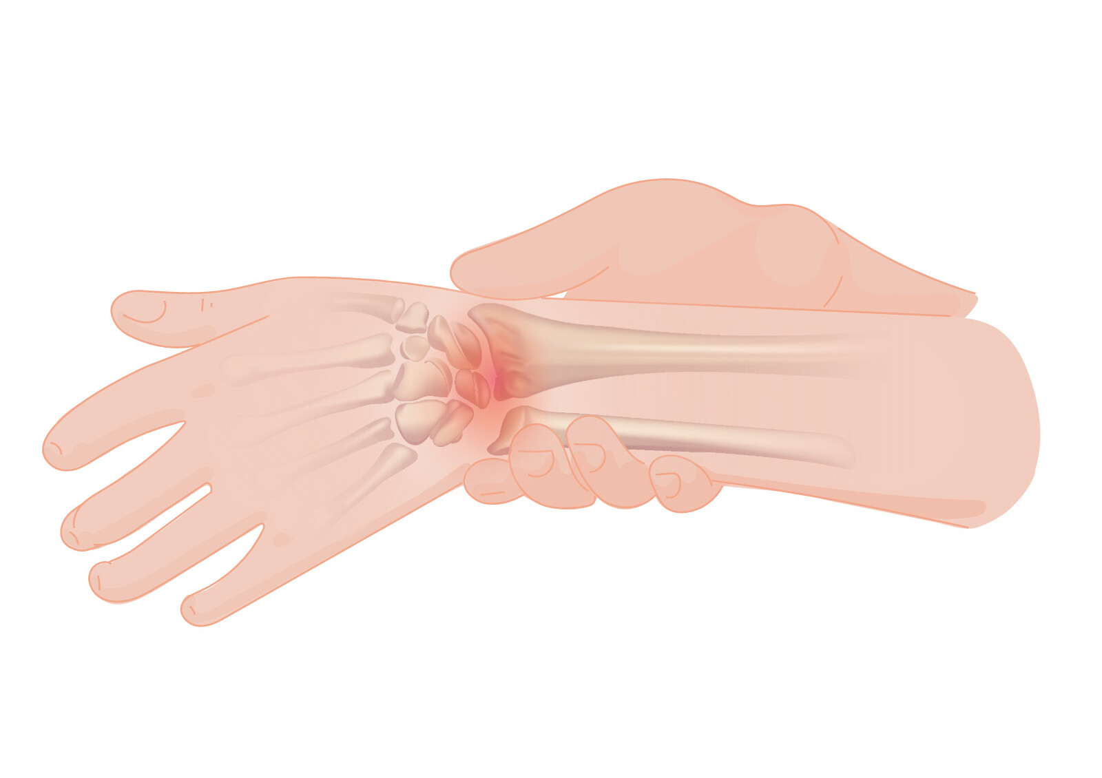 Joints – Wrist